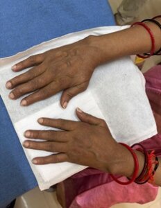 Arthritis 1