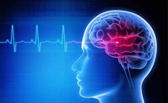 हार्ट अटैक की तरह ब्रेन स्ट्रोक भी गंभीर बीमारी, हो सकता है पैरालिसिस The Coverage