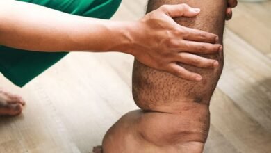 Filariasis Disease the coverage