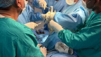 Knee replasment the coverage