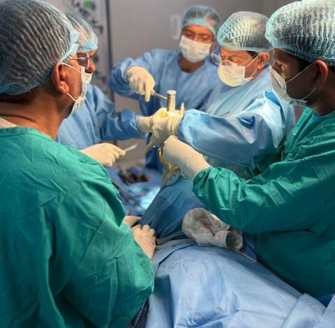 Knee replasment the coverage