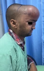 SGPGI the coverage 2