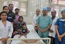 KGMU King George Medical University pediatric surgery