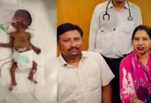 Children Medical Center Dr Ashutosh Verma Lucknow 2