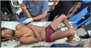 KGMU Trauma Surgey Emergency Dr Sameer Mishra Sonia Nityanand Lucknow 5