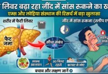 Fatty Liver Sleep Apnea Rmlims KGMU Sgpgi