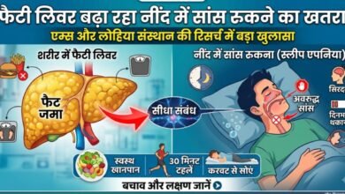 Fatty Liver Sleep Apnea Rmlims KGMU Sgpgi
