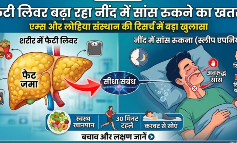 Fatty Liver Sleep Apnea Rmlims KGMU Sgpgi