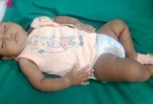 arm anorectal malformation the coverage