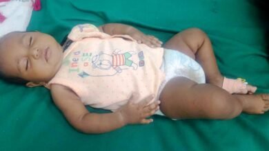 arm anorectal malformation the coverage
