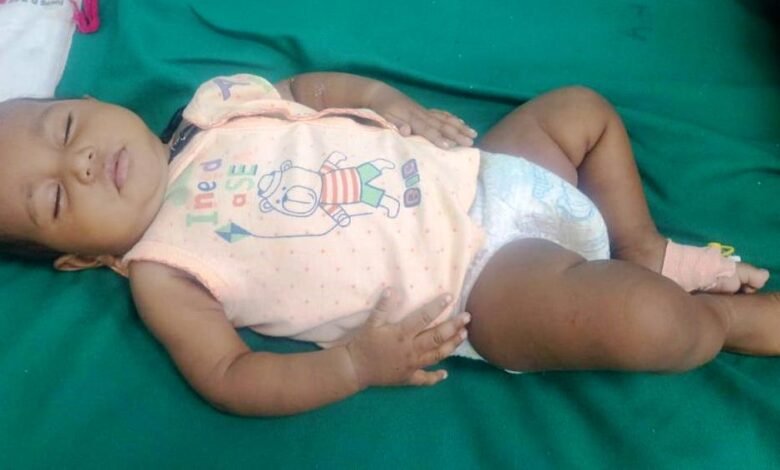 arm anorectal malformation the coverage