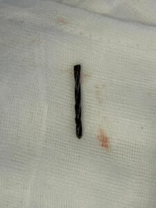 sgpgi apex trauma center chest surgery 1