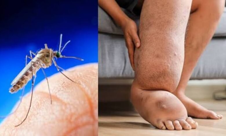 फाइलेरिया की दवा न खाने वालों को अब बच्चे समझाएंगे