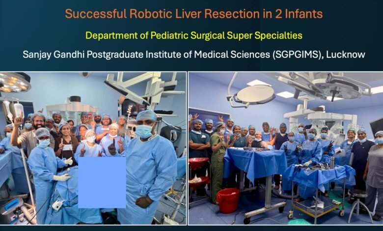 sgpgi liver suregery robotic surgery 1